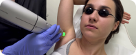 Laser Hair Removal